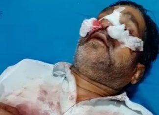 अब्दुल लतीफ आज मौत और ज़िंदगी की जंग लड़ रहा है,, ,, थाना कोतवाली कल्याण जी का रास्ता दूसरे चौराहे का है यह मामला,, सीएलजी मेंबर इकराम कुरैशी है इसका जिम्मेदार,, ,अब्दुल लतीफ के परिजन पुलिस की कार्रवाई से है ना खुश,,आज 10 दिन तक गिरफ्तारी नहीं होने पर हैं खफा ,,24 जुलाई को कोतवाली थाना में हो चुकी है एफ.आई. आर. दर्ज,,