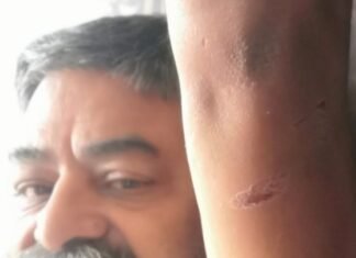 वरिष्ठ पत्रकार गोपाल गुप्ता पर जानलेवा हमला,विगत 3 दिनों से घर आ कर दे रहा है जान से मारने की धमकी,, सांगानेर एसएचओ हरिसिंह दूधवाल कहते हैं वह पागल है, हम उसे थाने नहीं रख सकते,, तो क्या कोलोनिवासियों पर हमले के लिए खुला छोड दोगे ? पत्रकारों में रोष व्याप्त,लामबन्द होने की तैयारी,,